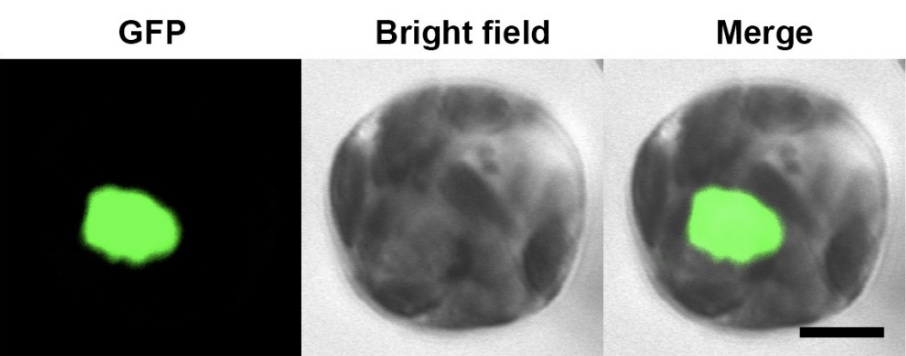 Image comparison og GFP vs. Bright field vs. Merge